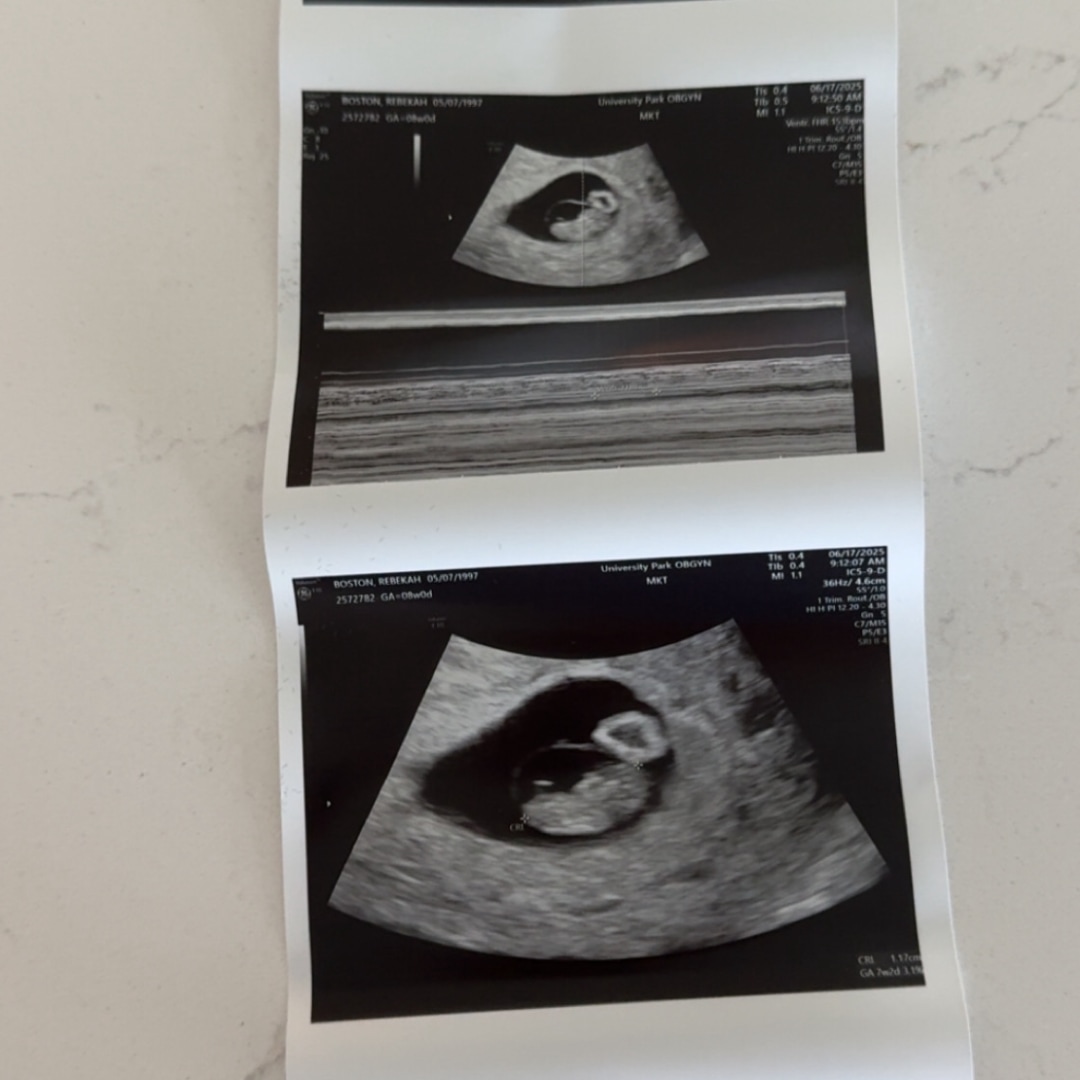 Photo shared by Rebekah for their Babylist baby registry.