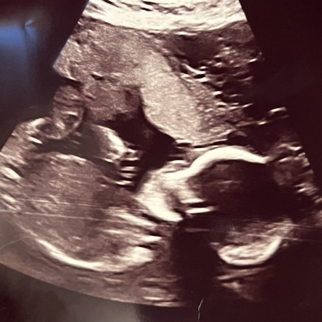 Photo shared by Angie for their Babylist baby registry.