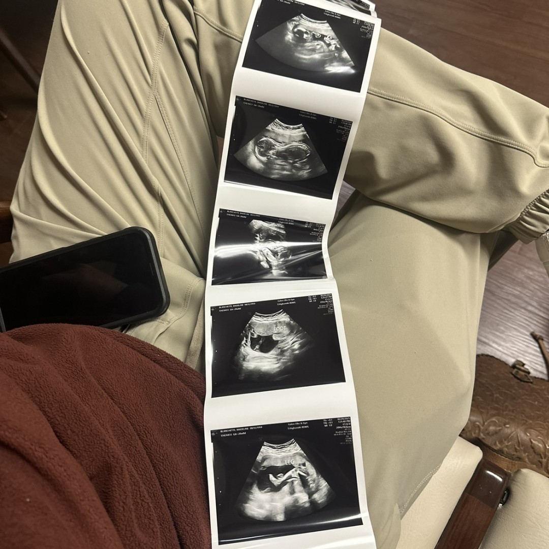 Photo shared by Madeline for their Babylist baby registry.