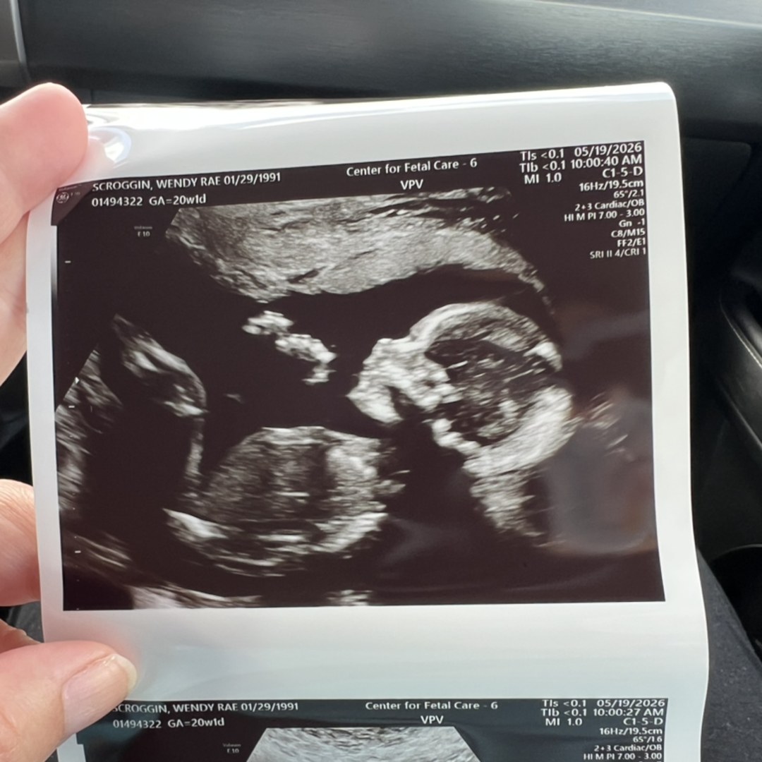 Photo shared by Wendy for their Babylist baby registry.