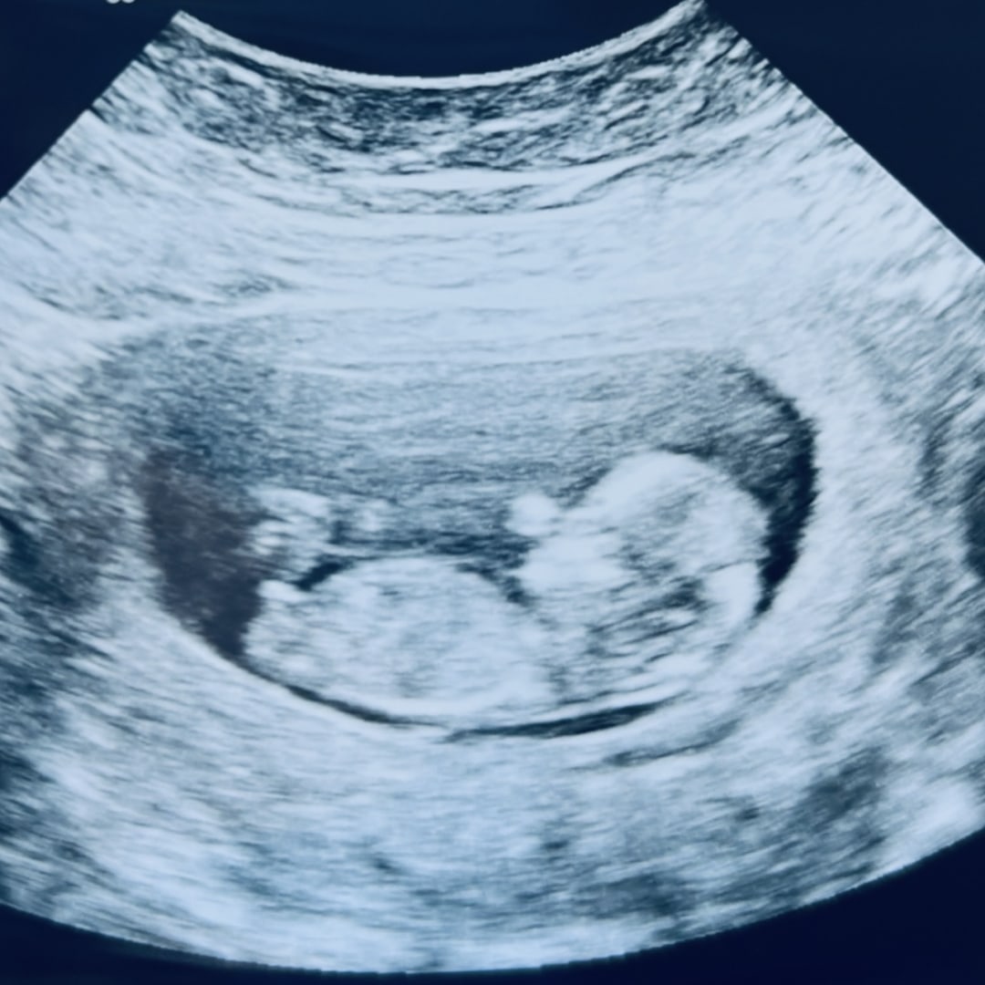 Photo shared by Emily for their Babylist baby registry.