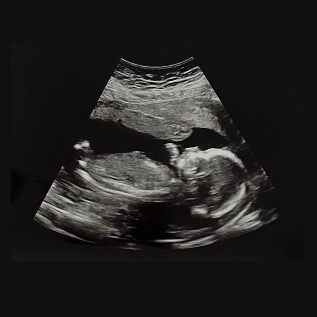 Photo shared by Kayla for their Babylist baby registry.