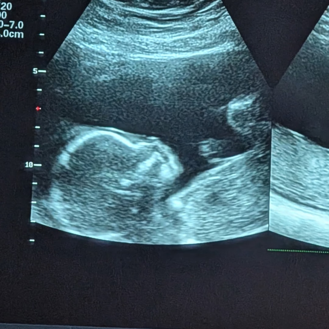Photo shared by Alexandra for their Babylist baby registry.