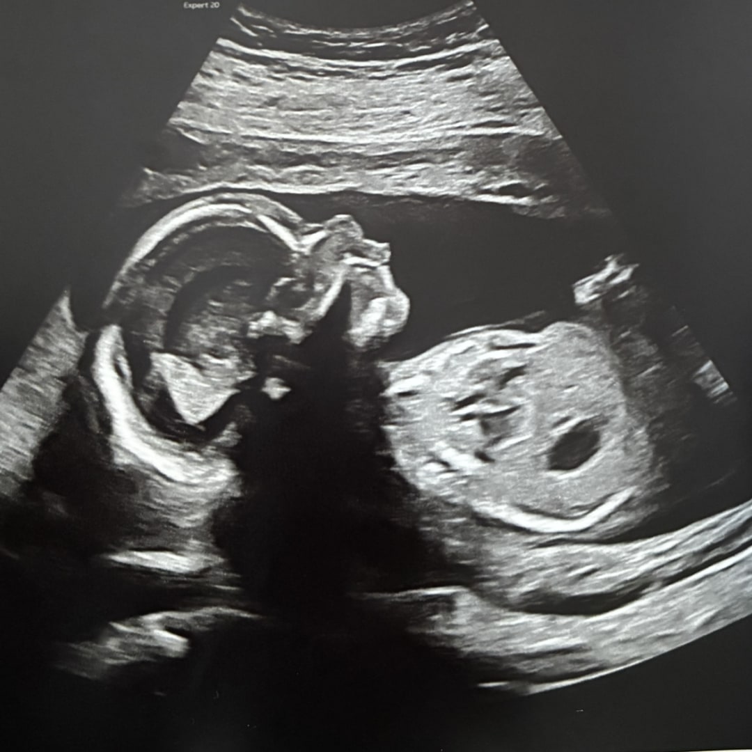 Photo shared by Mary for their Babylist baby registry.