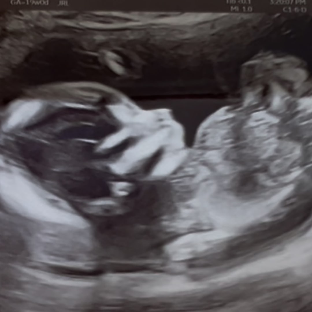 Photo shared by Maranda for their Babylist baby registry.