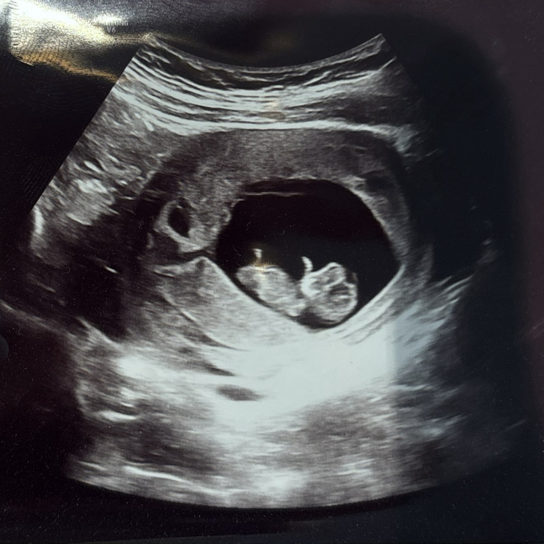 Photo shared by Landyn for their Babylist baby registry.