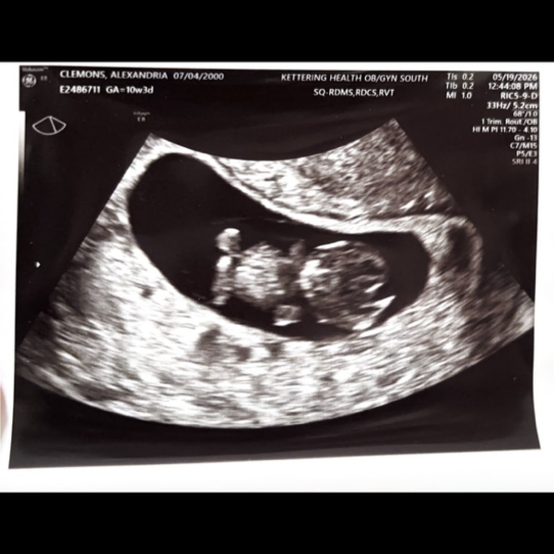 Photo shared by Alex for their Babylist baby registry.