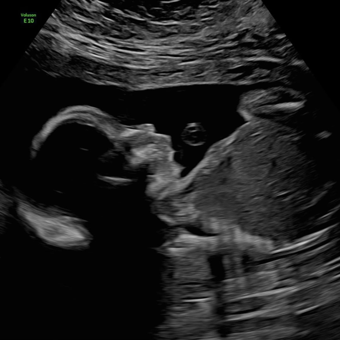 Photo shared by Hannah for their Babylist baby registry.