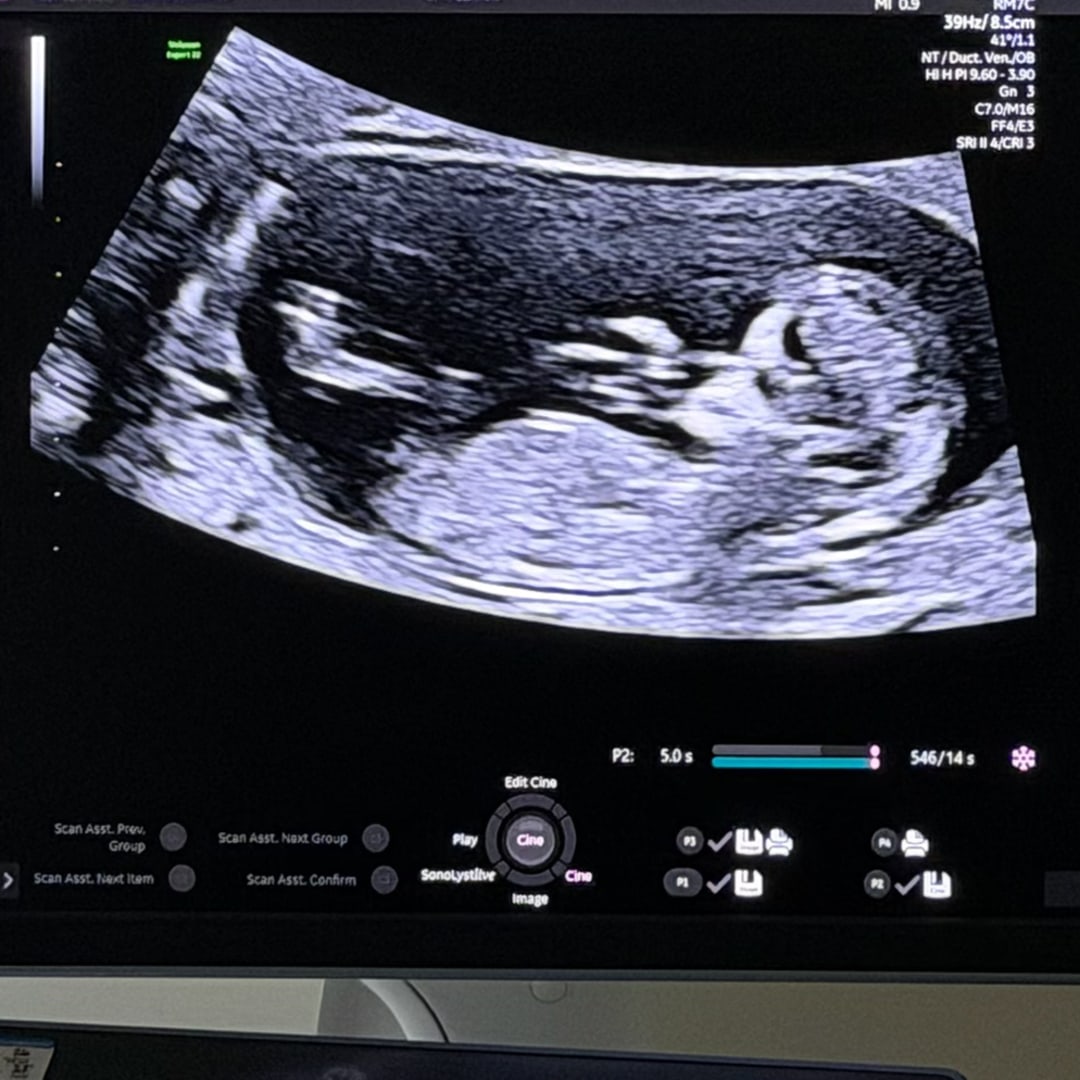 Photo shared by Andrea & Miguel for their Babylist baby registry.