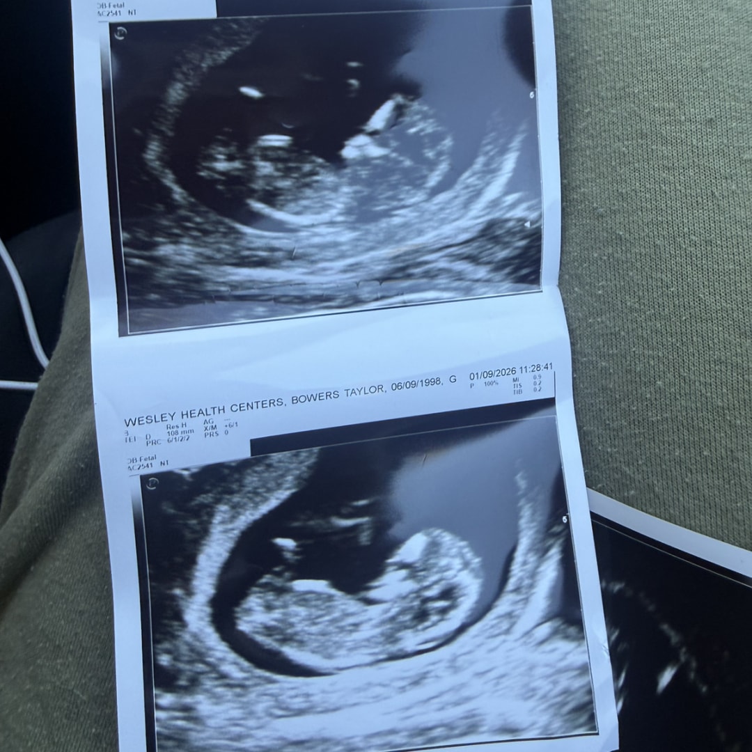 Photo shared by Taylor for their Babylist baby registry.