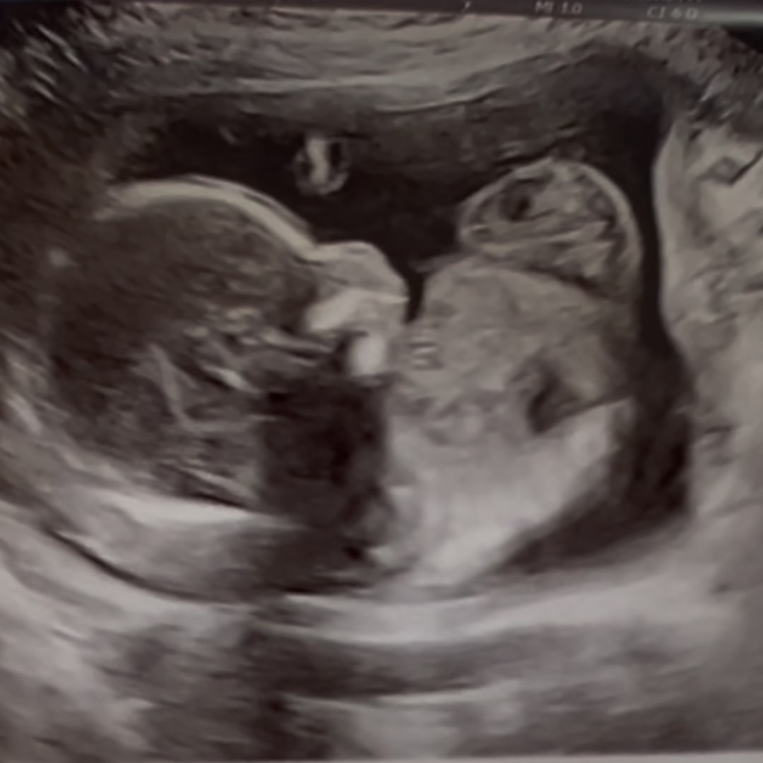 Photo shared by Maranda for their Babylist baby registry.