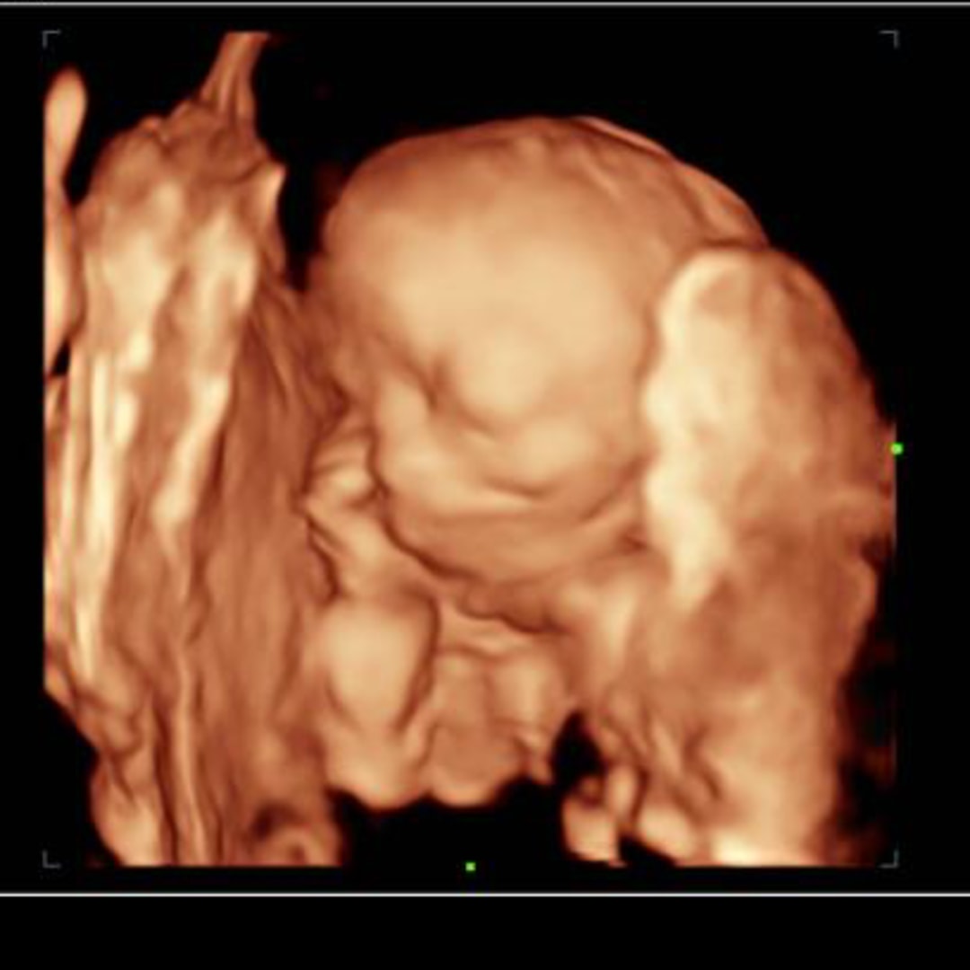 Photo shared by Allison for their Babylist baby registry.