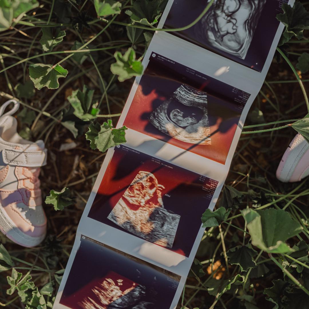 Photo shared by Michela for their Babylist baby registry.