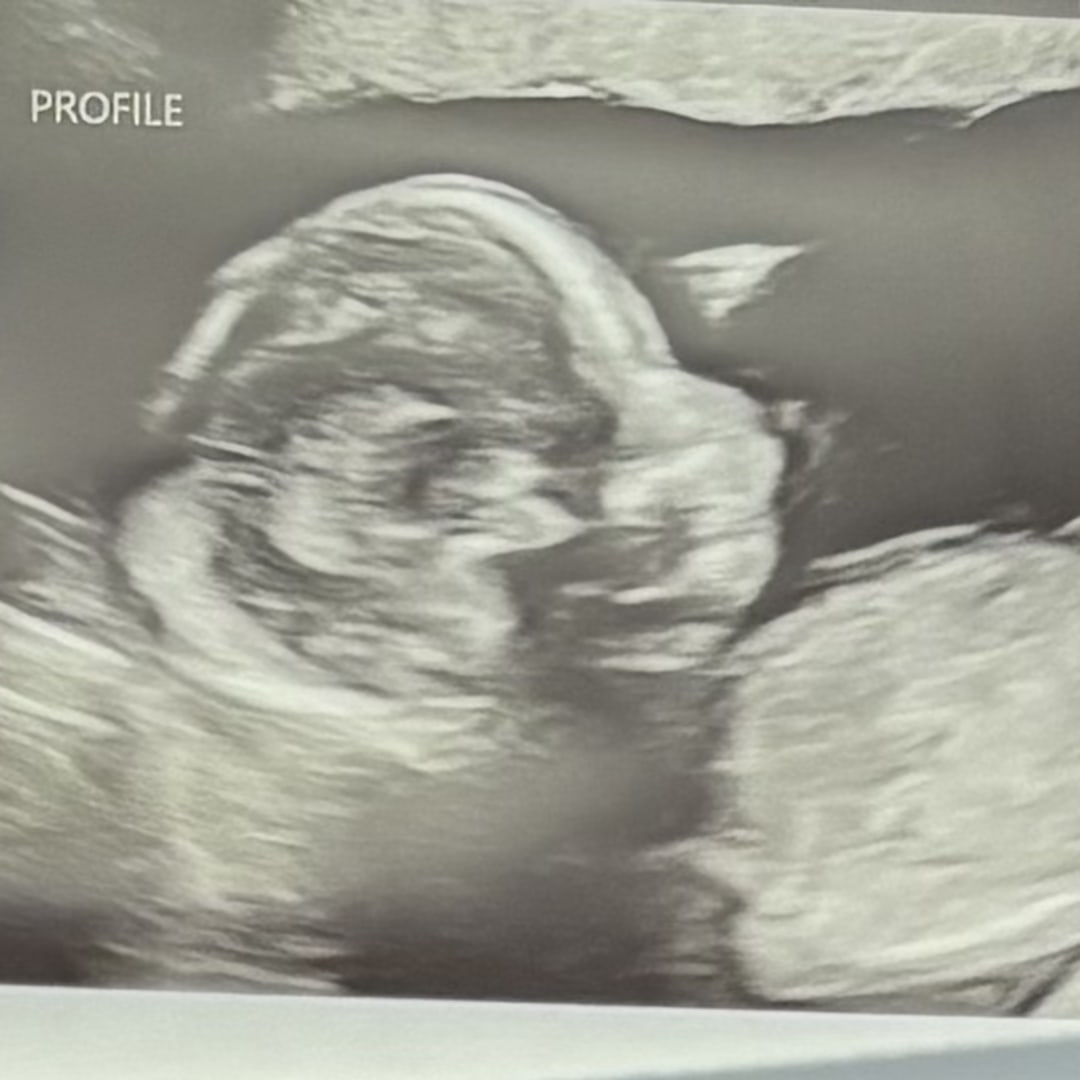 Photo shared by Isabel for their Babylist baby registry.