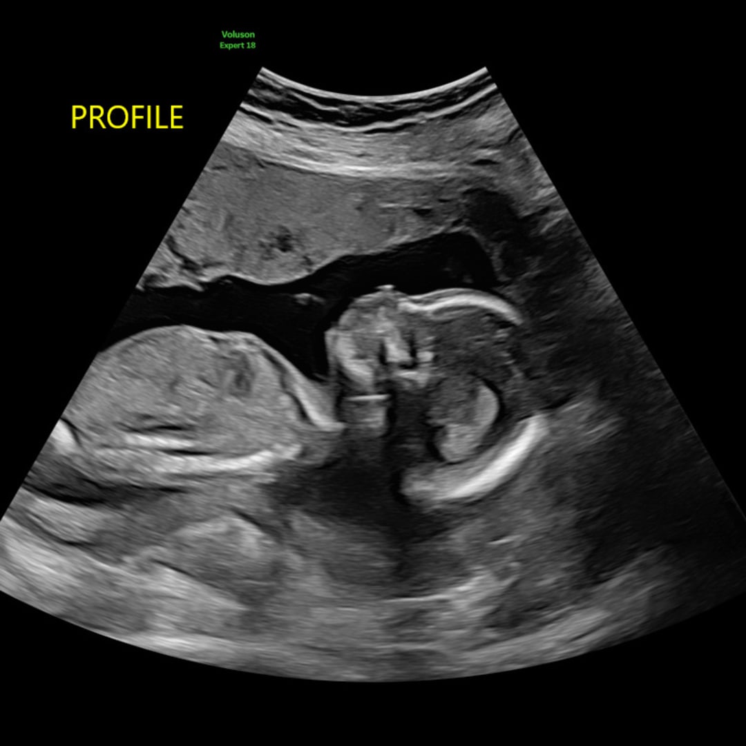 Photo shared by Cass for their Babylist baby registry.