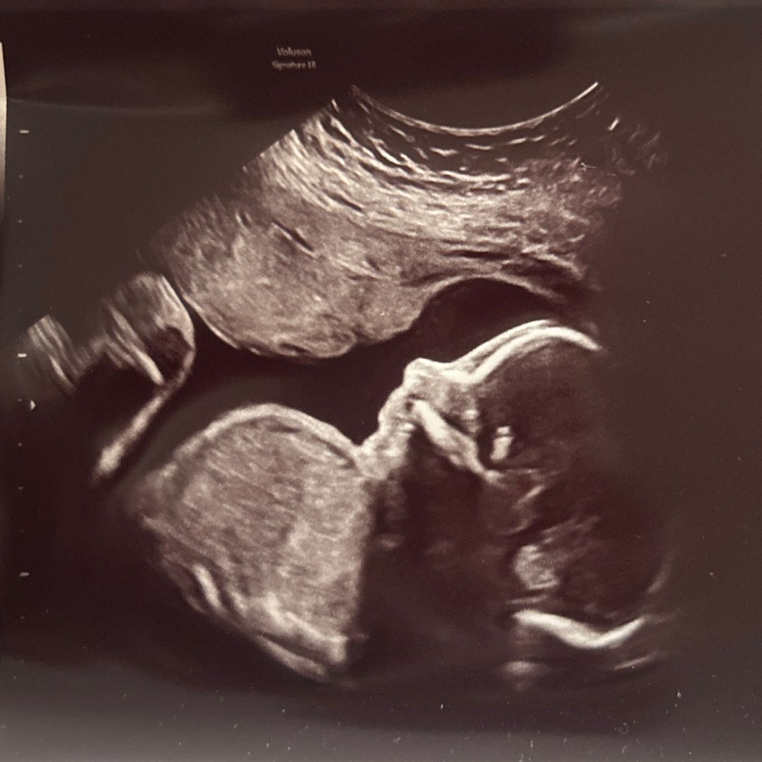 Photo shared by Ariel for their Babylist baby registry.