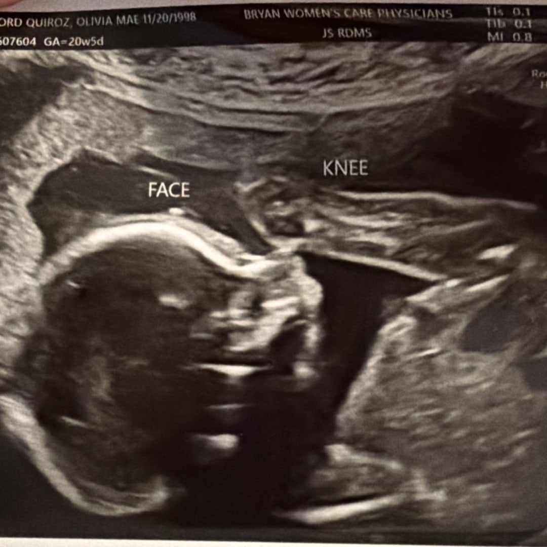 Photo shared by Olivia for their Babylist baby registry.