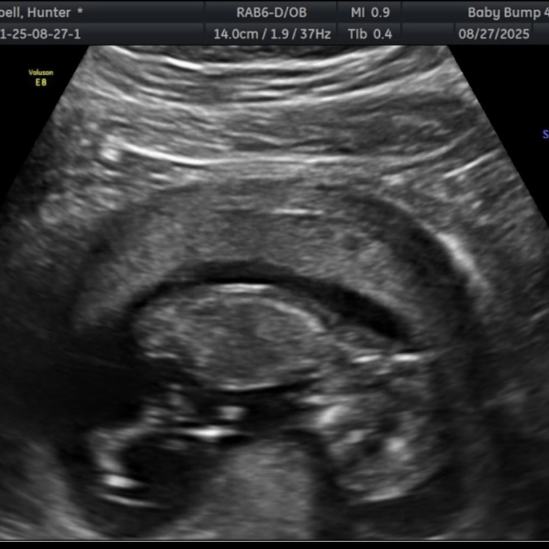 Photo shared by Hunter for their Babylist baby registry.