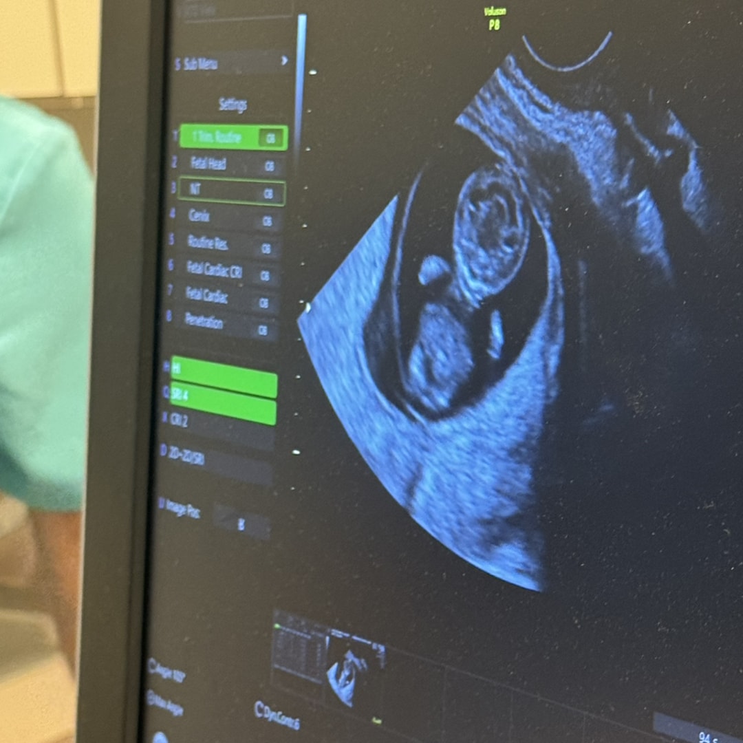 Photo shared by Rebecca for their Babylist baby registry.