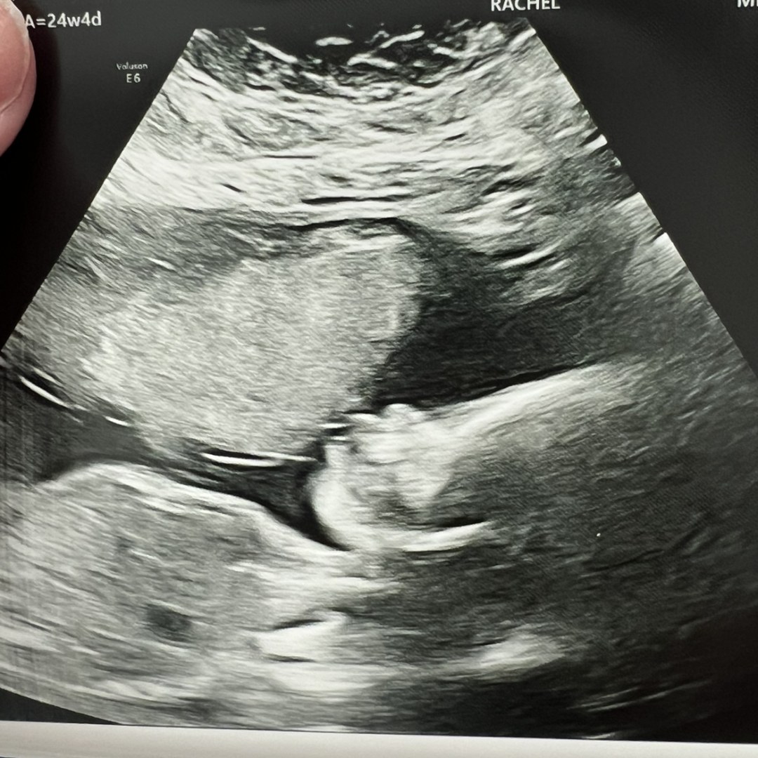 Photo shared by Lara for their Babylist baby registry.