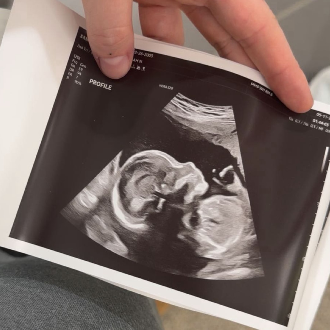 Photo shared by Bryannah for their Babylist baby registry.