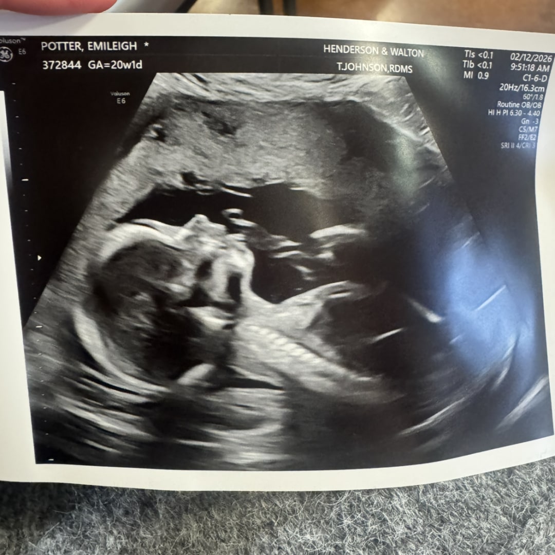 Photo shared by Emileigh for their Babylist baby registry.