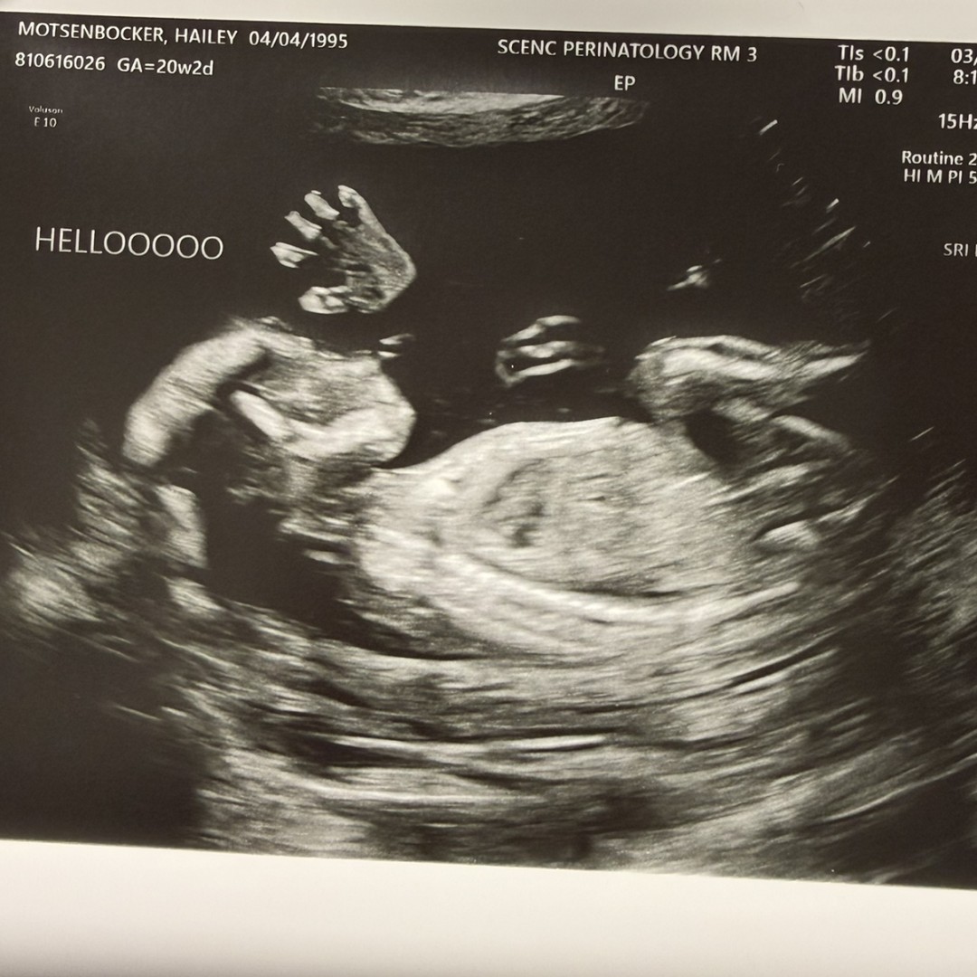 Photo shared by Hailey for their Babylist baby registry.