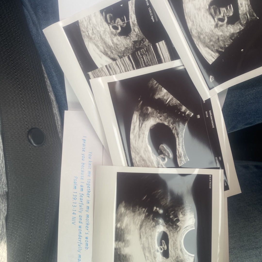 Photo shared by Mackienzie for their Babylist baby registry.