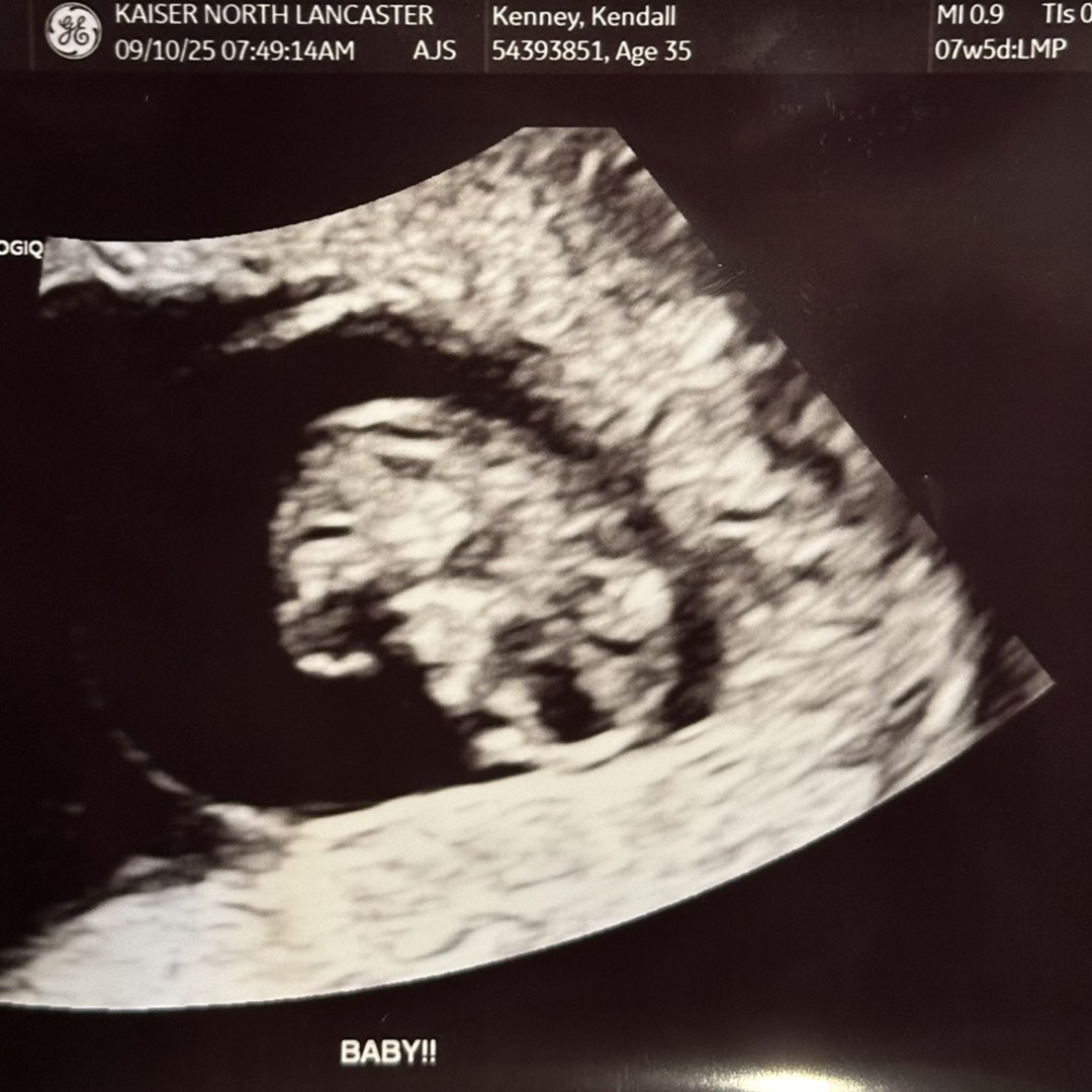 Photo shared by Kendall for their Babylist baby registry.