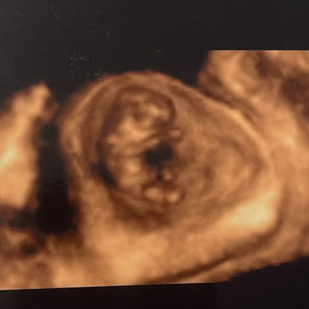 Photo shared by Kimmy for their Babylist baby registry.