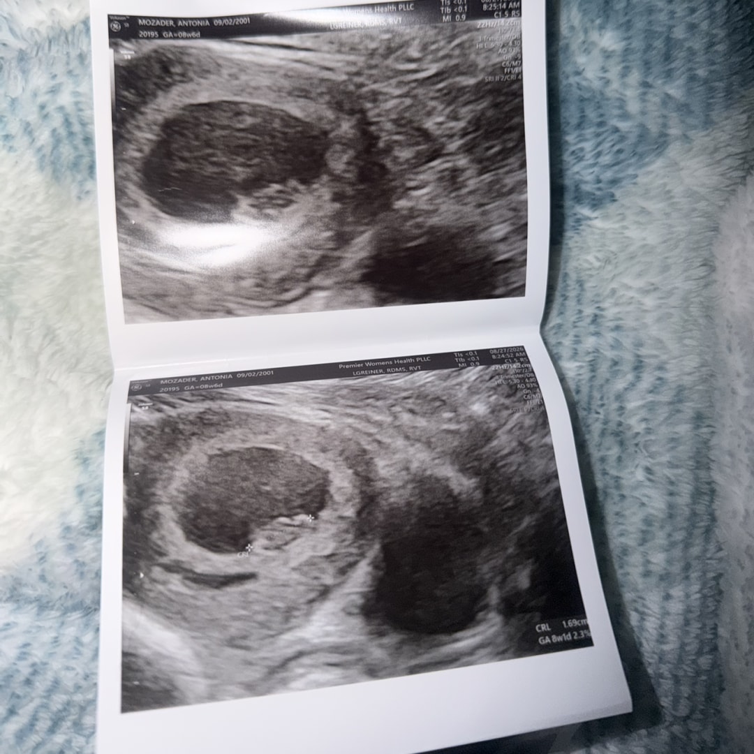 Photo shared by Antonia for their Babylist baby registry.