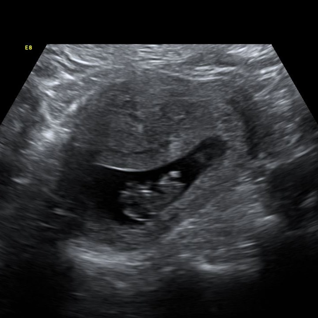 Photo shared by Casey for their Babylist baby registry.