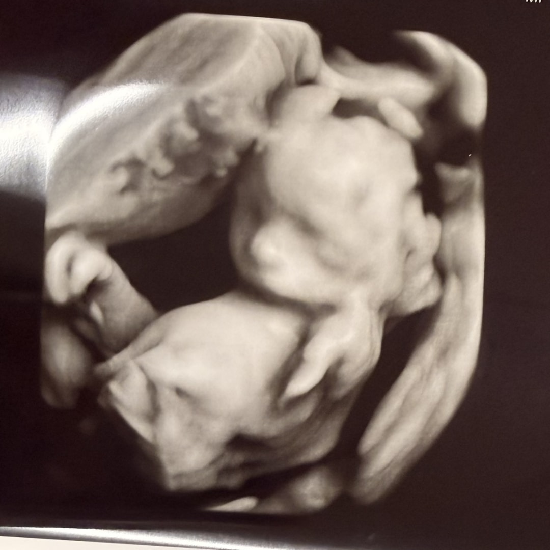Photo shared by Heather for their Babylist baby registry.