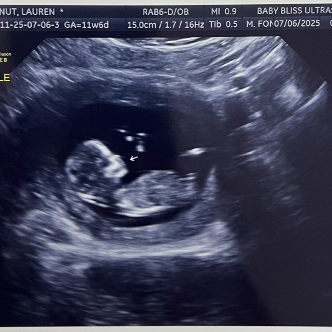 Photo shared by Lauren for their Babylist baby registry.