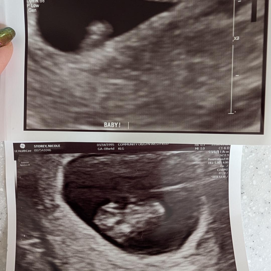 Photo shared by Nicole for their Babylist baby registry.