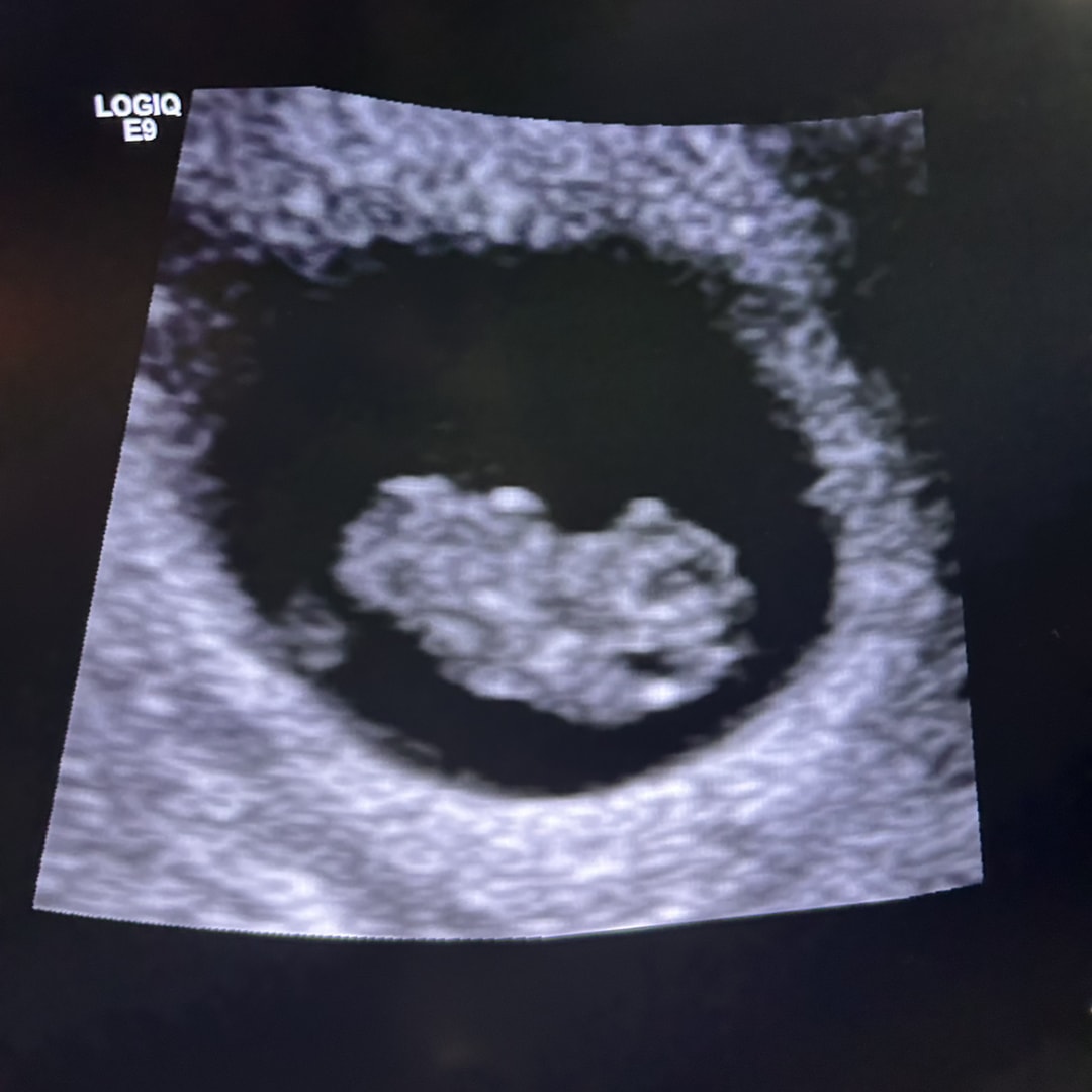 Photo shared by Kadyn for their Babylist baby registry.