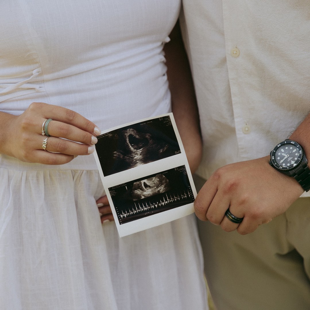 Photo shared by Lyndsey for their Babylist baby registry.