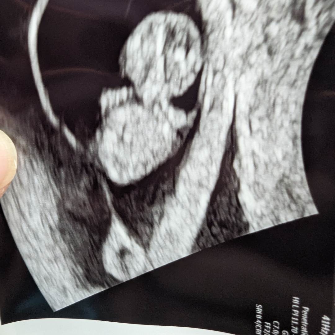 Photo shared by Holly for their Babylist baby registry.