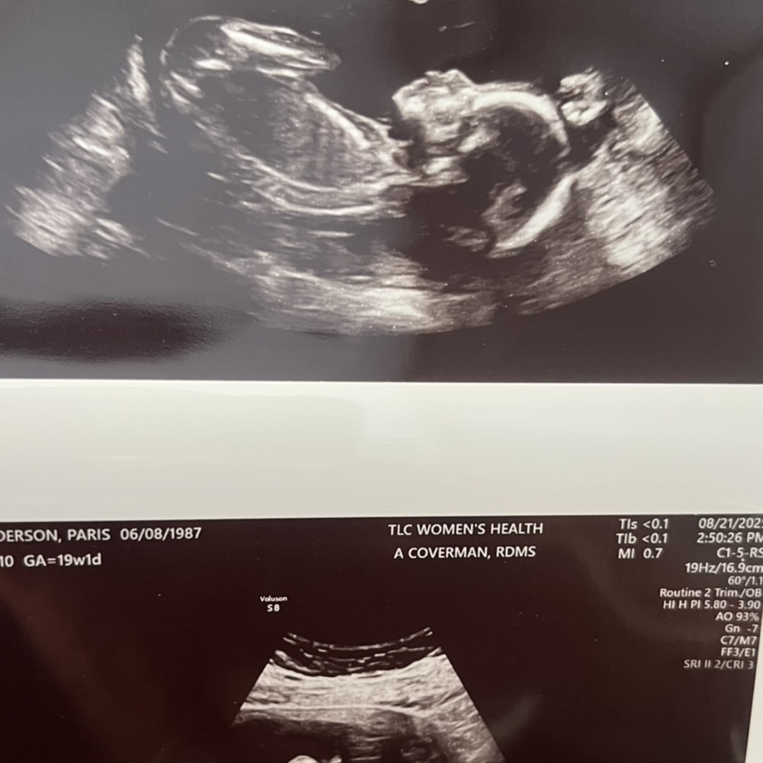 Photo shared by Paris for their Babylist baby registry.