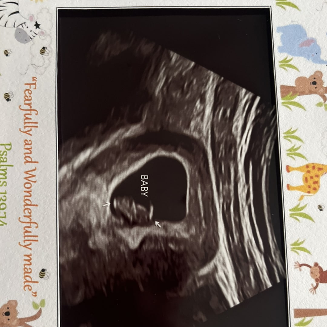 Photo shared by Ashlyn for their Babylist baby registry.