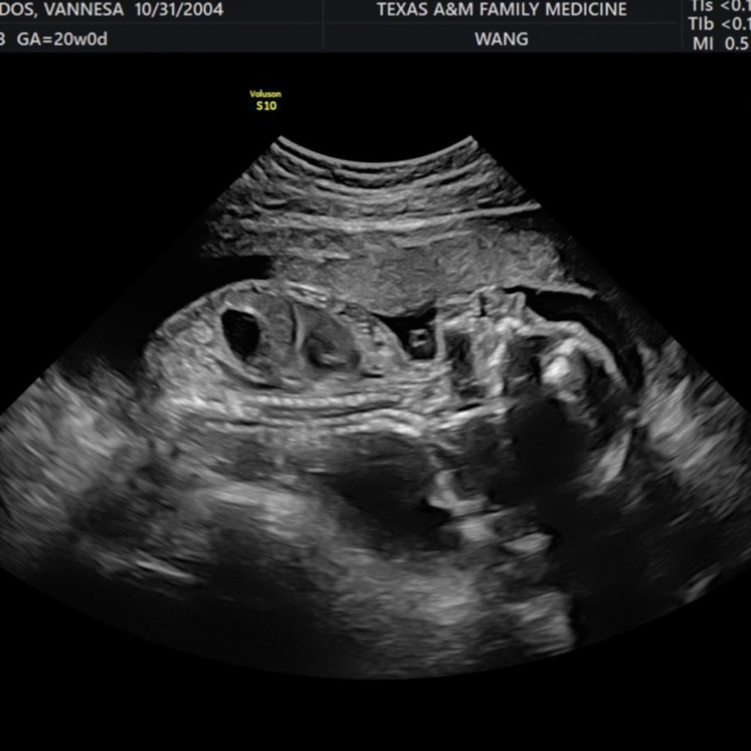 Photo shared by Vannesa for their Babylist baby registry.