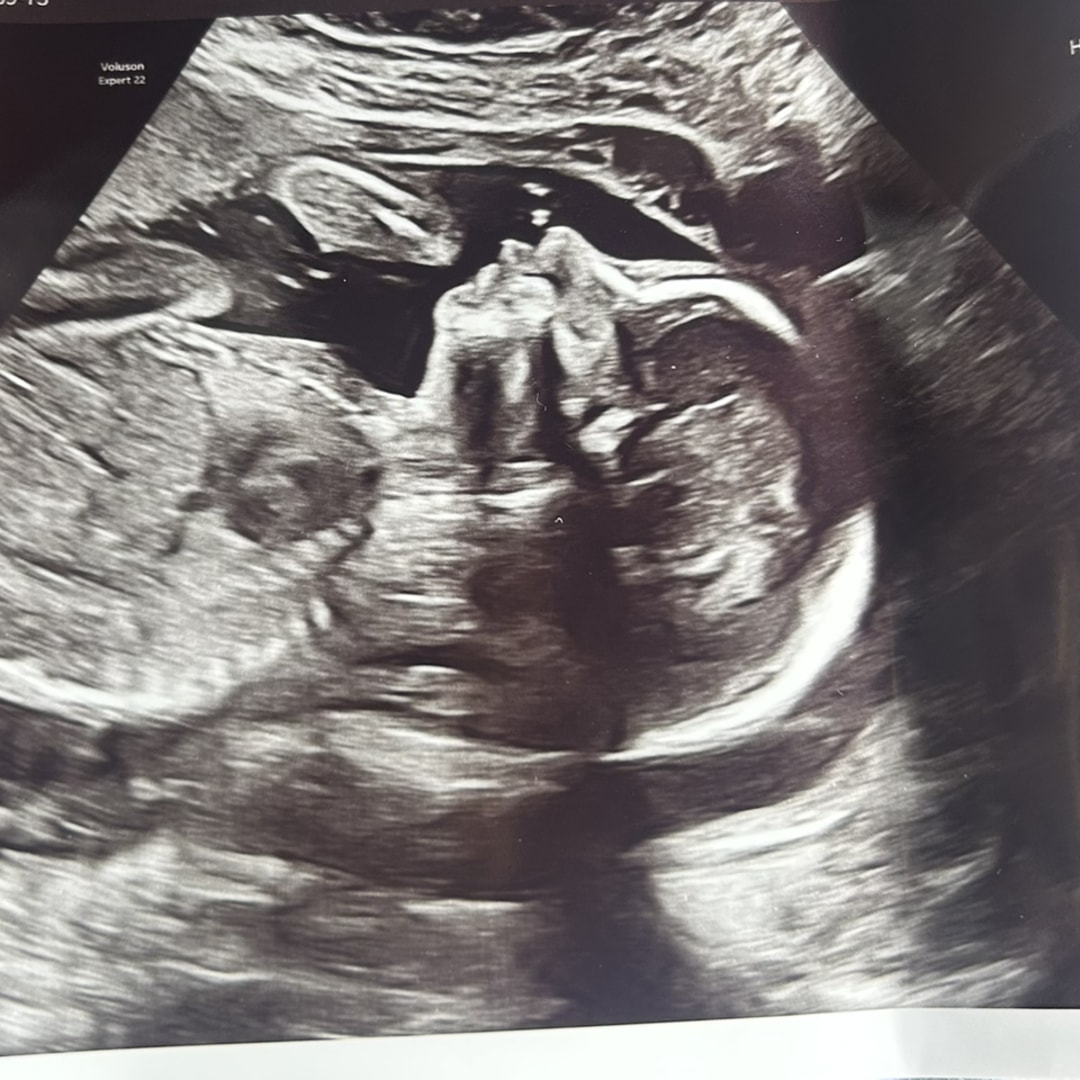 Photo shared by Alyssa for their Babylist baby registry.