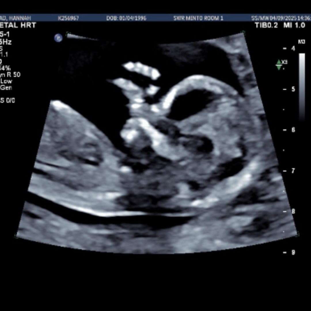 Photo shared by Hannah for their Babylist baby registry.