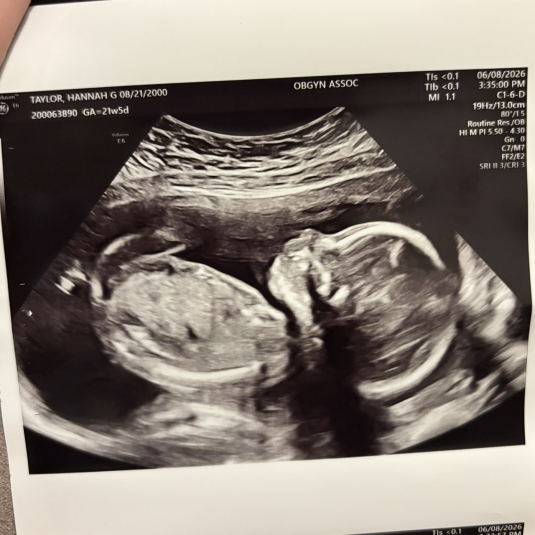 Photo shared by Hannah for their Babylist baby registry.