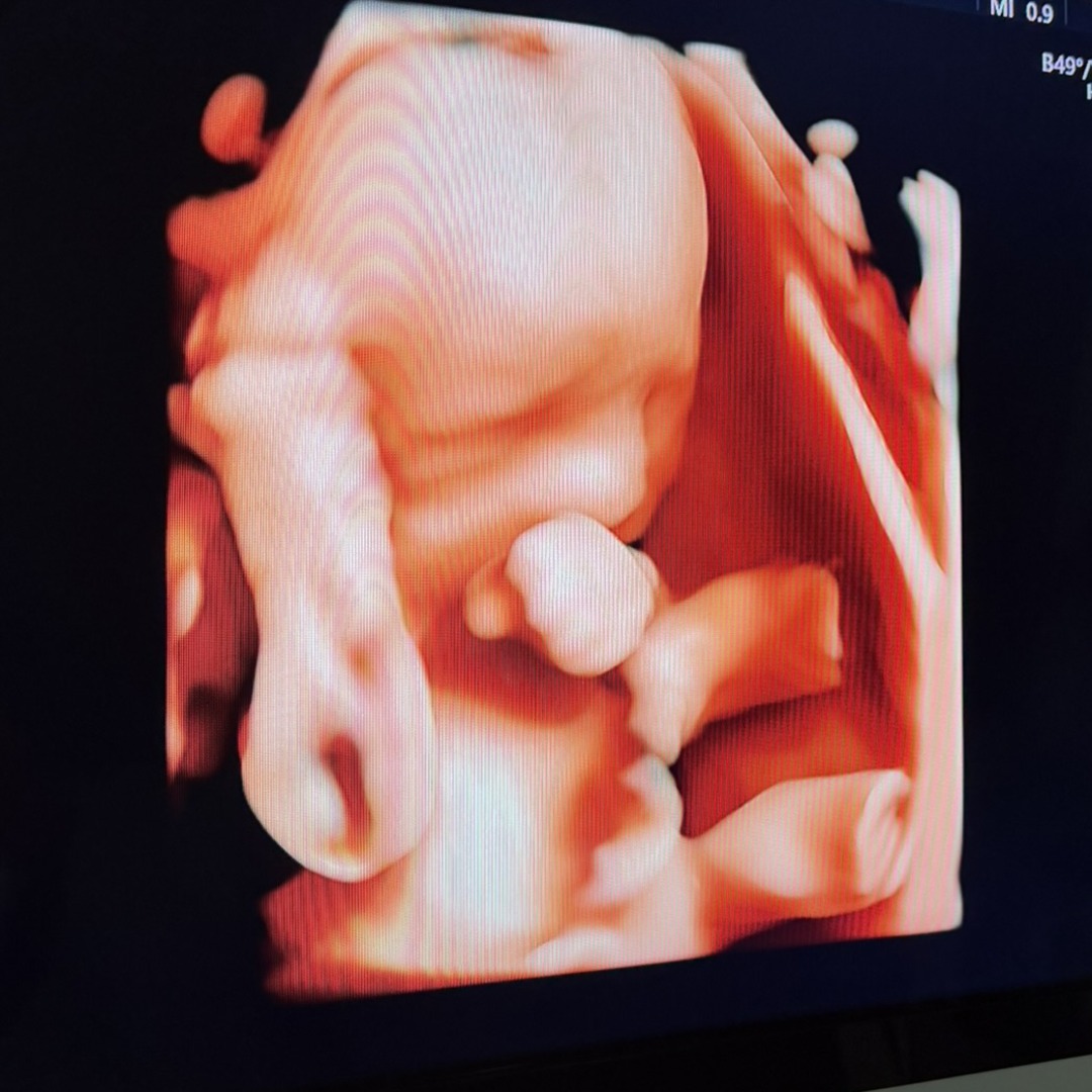 Photo shared by Morgan for their Babylist baby registry.