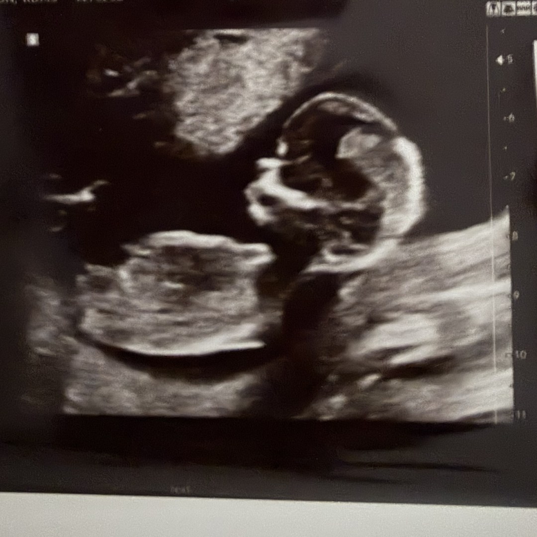Photo shared by Caylen for their Babylist baby registry.