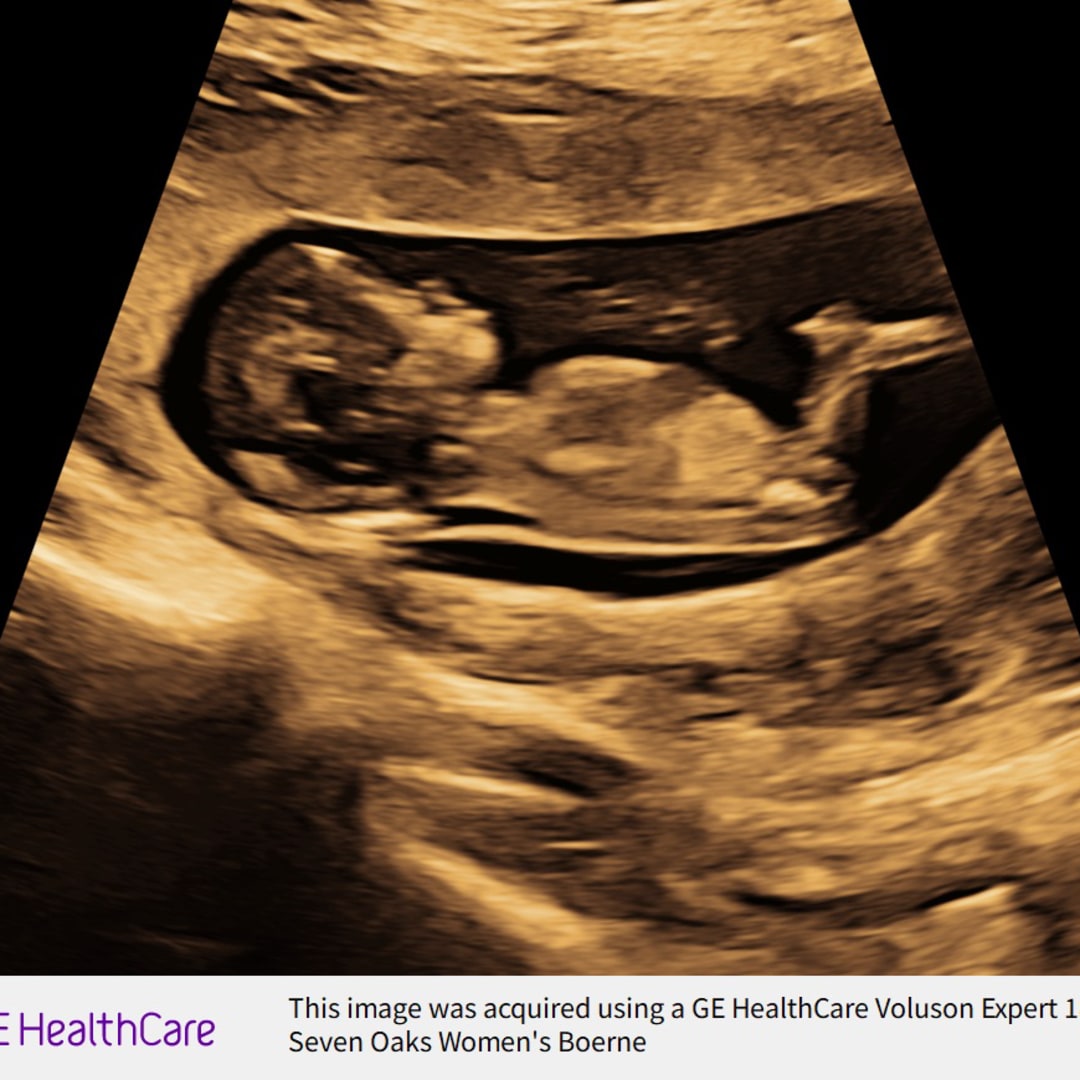Photo shared by Sarah for their Babylist baby registry.