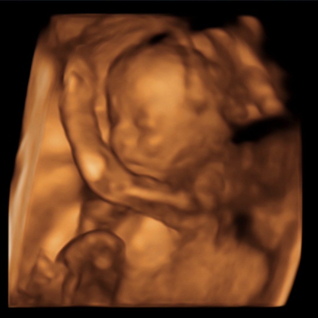Photo shared by Ally for their Babylist baby registry.