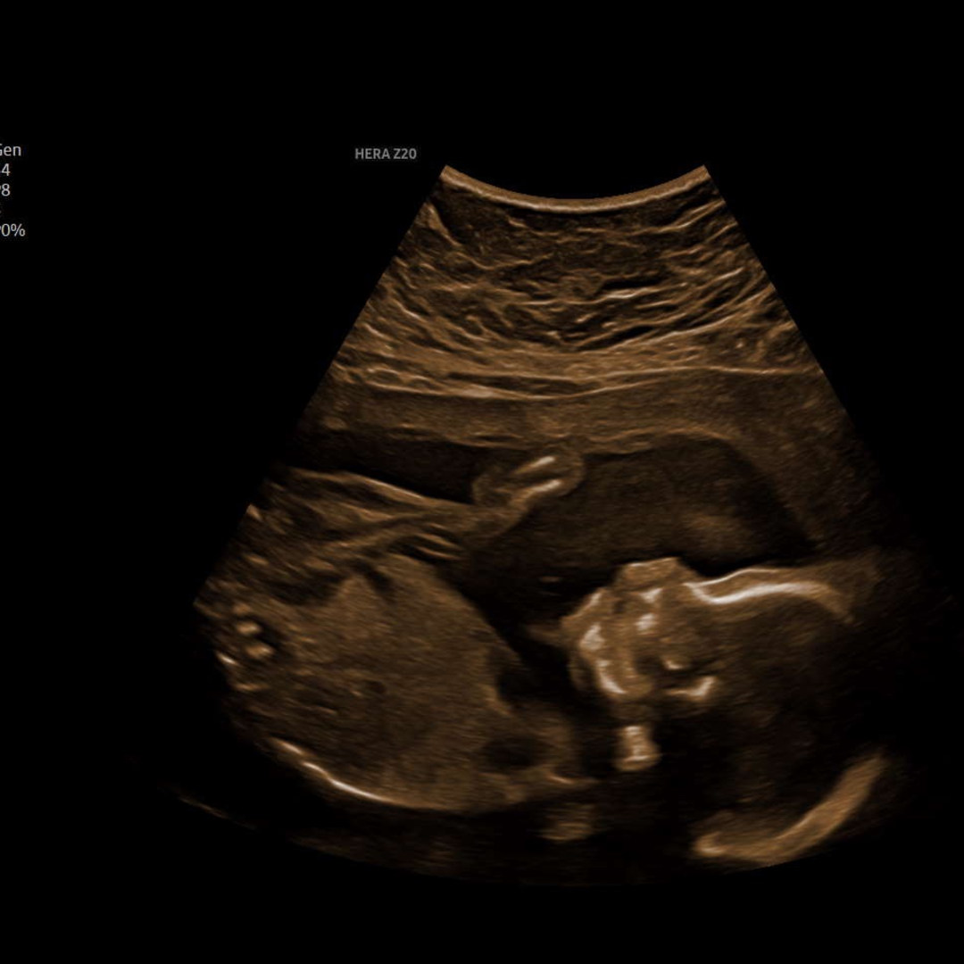 Photo shared by Megan for their Babylist baby registry.