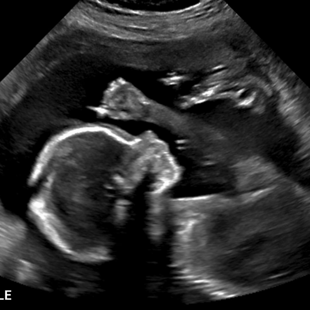 Photo shared by Kailey for their Babylist baby registry.
